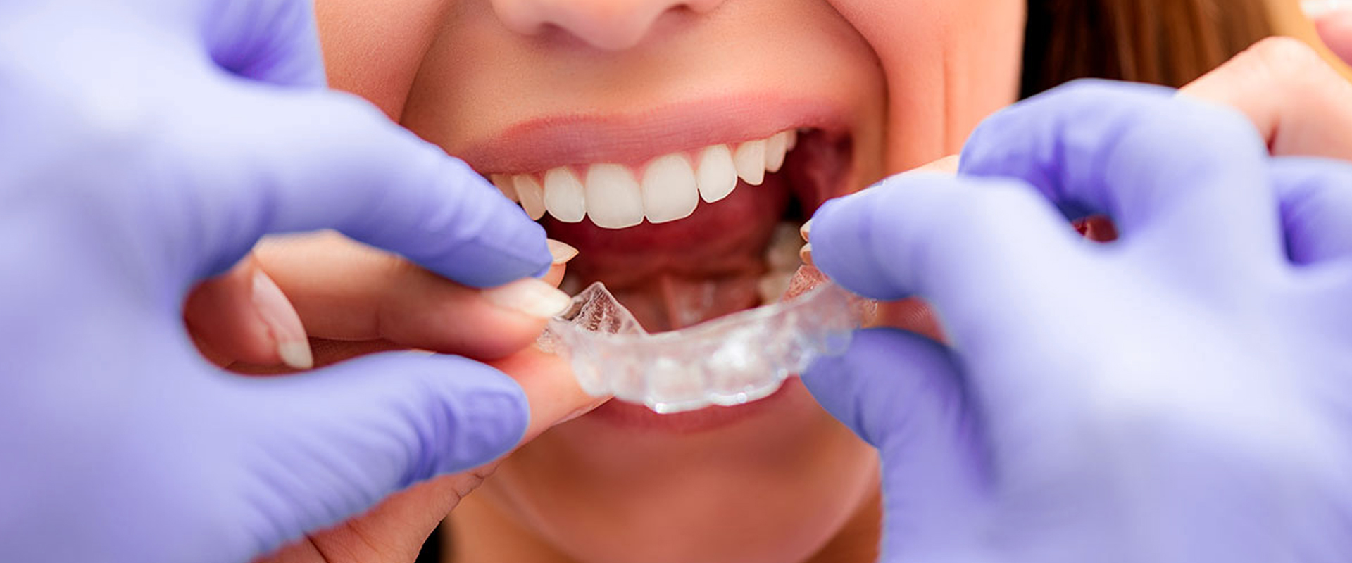 "Doutor, quando meu aparelho vai sair?"