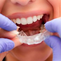 "Doutor, quando meu aparelho vai sair?"