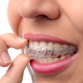 bt_Invisalign